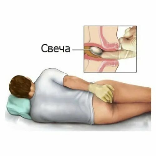 Как часто можно использовать свечи