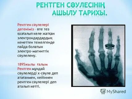 Қыздардың рентген сәулелері жабысқан жыныстық объектілері