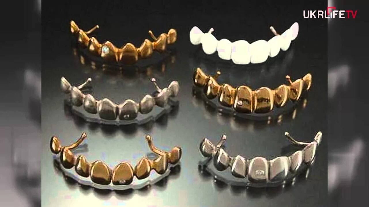 Сколько стоит металлические зубы. Металлические зубные протезы. Металлические зубные коронки. Металлические коронки на зубы с напылением. Металлические коронки стальные зубы.