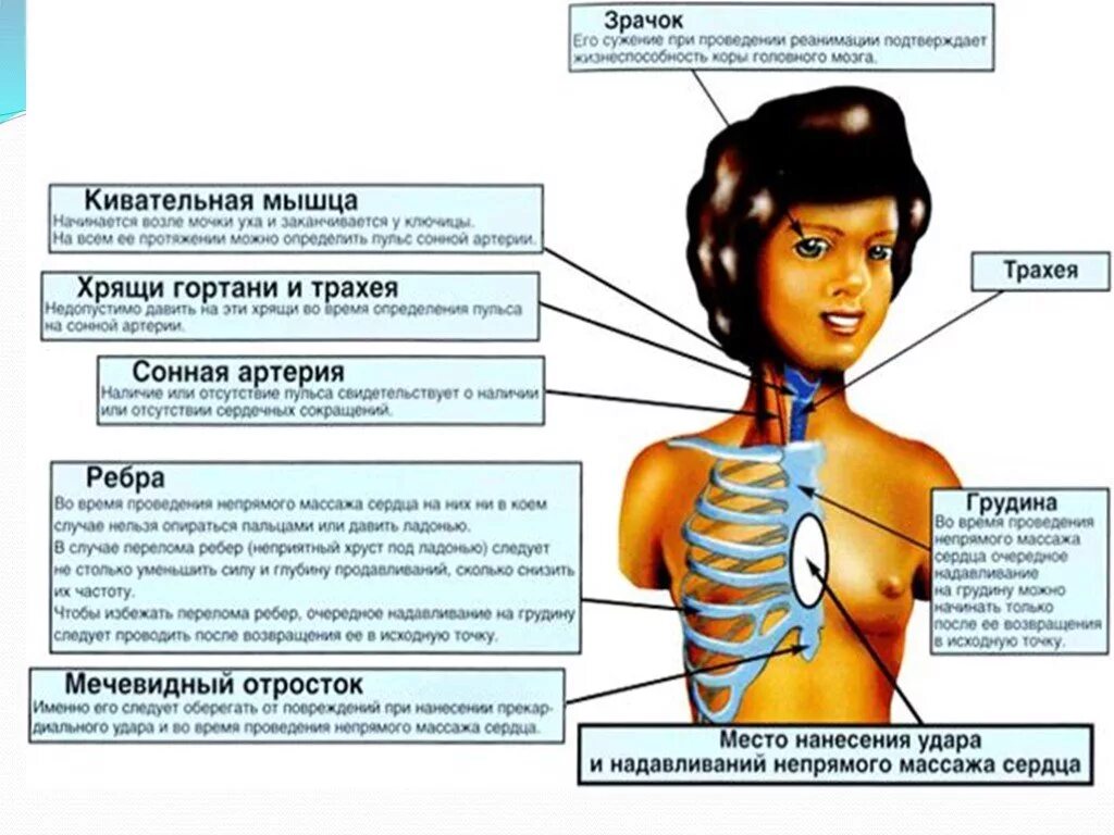 Мечевидный отросток грудной клетки. Анатомические ориентиры для проведения сердечно-легочной реанимации. Мочевидный от Росток грузины. Меченосеныц отросток грудинв.