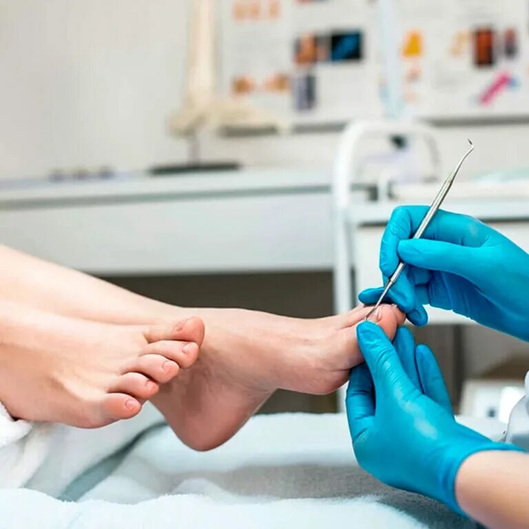 Подолог это простыми словами. Подолог, вросший ноготь, медицинский педикюр. подологический педикюр. медицинский аппаратный педикюр. мастер педикюра подолог.