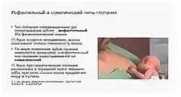 Инфантильное глотание