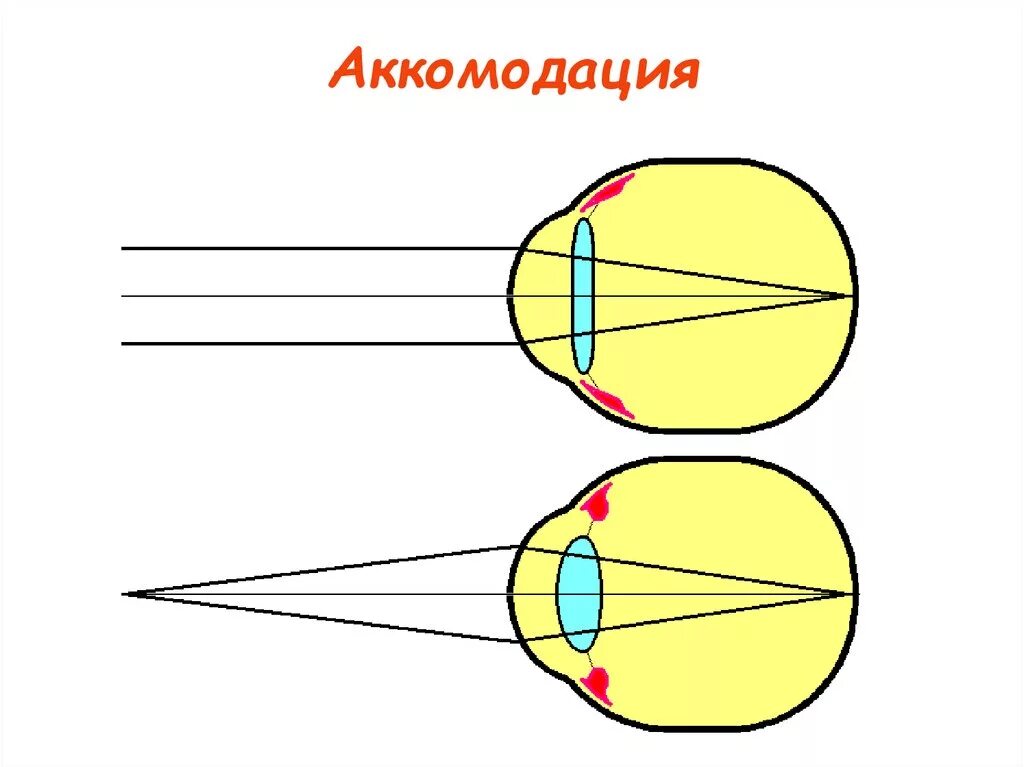 Фокусировка глаза человека. Схема аккомодации хрусталика. Аппарат аккомодации глаза схема. Спазм аккомодации хрусталика. Спазм аккомодации схема.