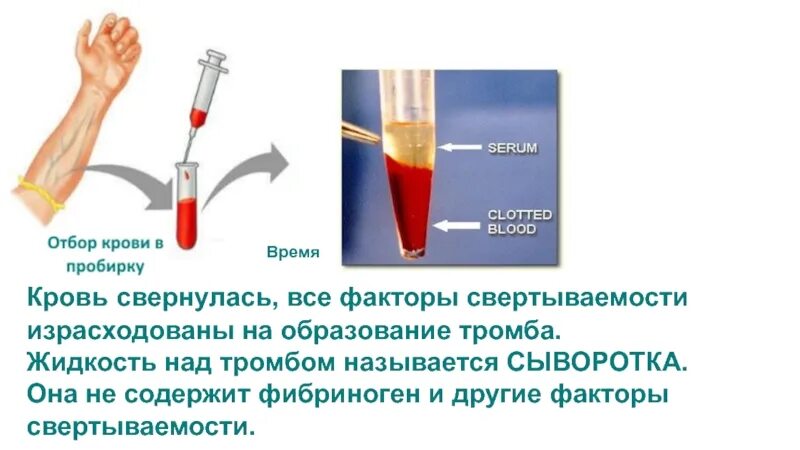 Почему при сдаче крови кровь свернулась. Сыворотка крови не сворачивается. Сыворотка крови содержит фибриноген. Сыворотка свертывается. Свернувшаяся кровь в пробирке.