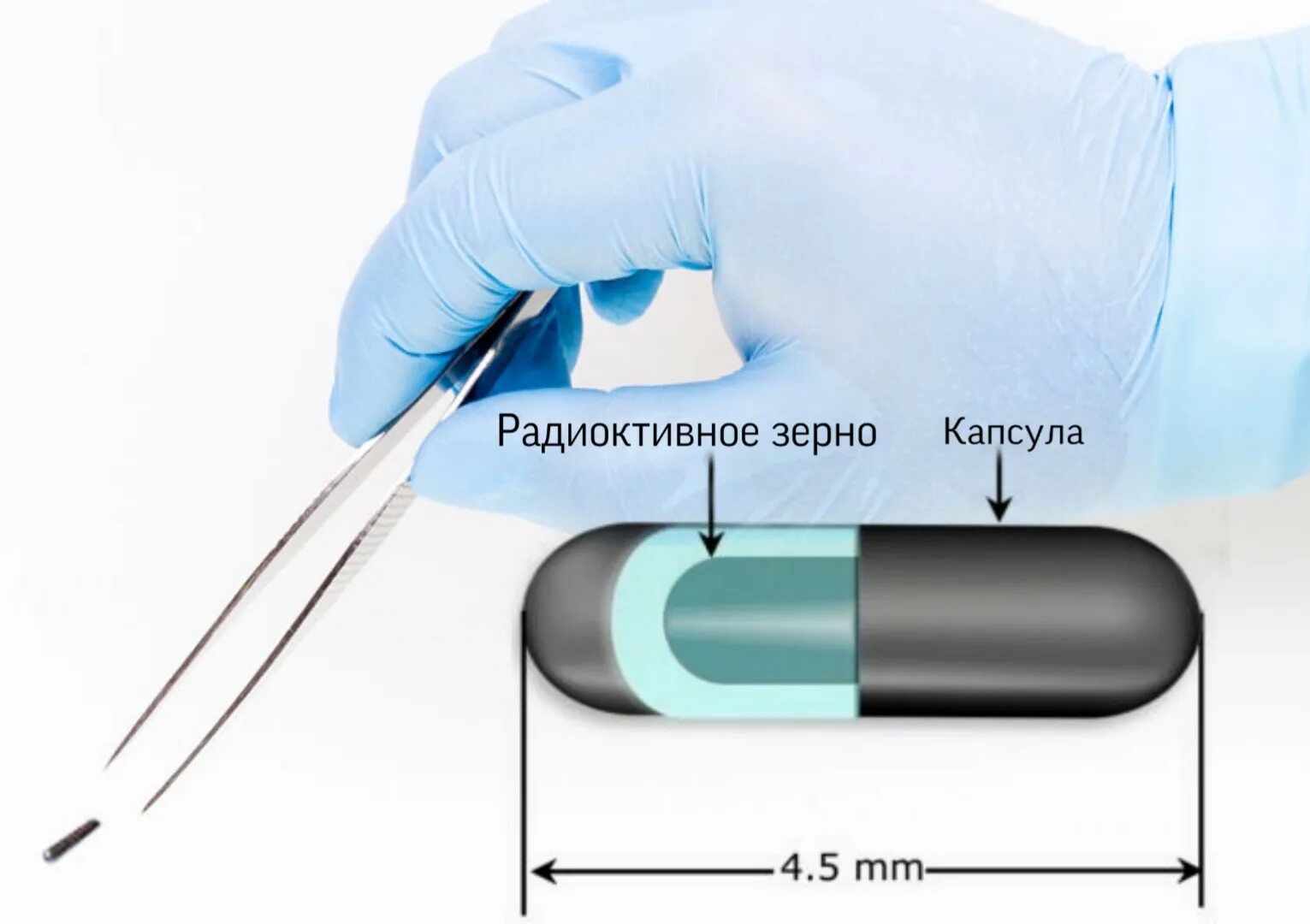 Предстательная железа капсула. Аппликационная брахитерапия. Контактная лучевая терапия брахитерапия это.