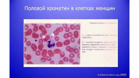 Определение полового хроматина