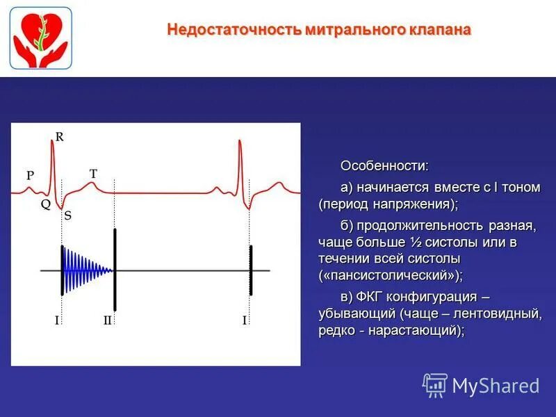 Шум при митральной недостаточности. Митральная недостаточность фонокардиограмма. Фонокардиограмма при митральной недостаточности. Митральная недостаточность ФКГ. Митральная недостаточность фонокардиография.