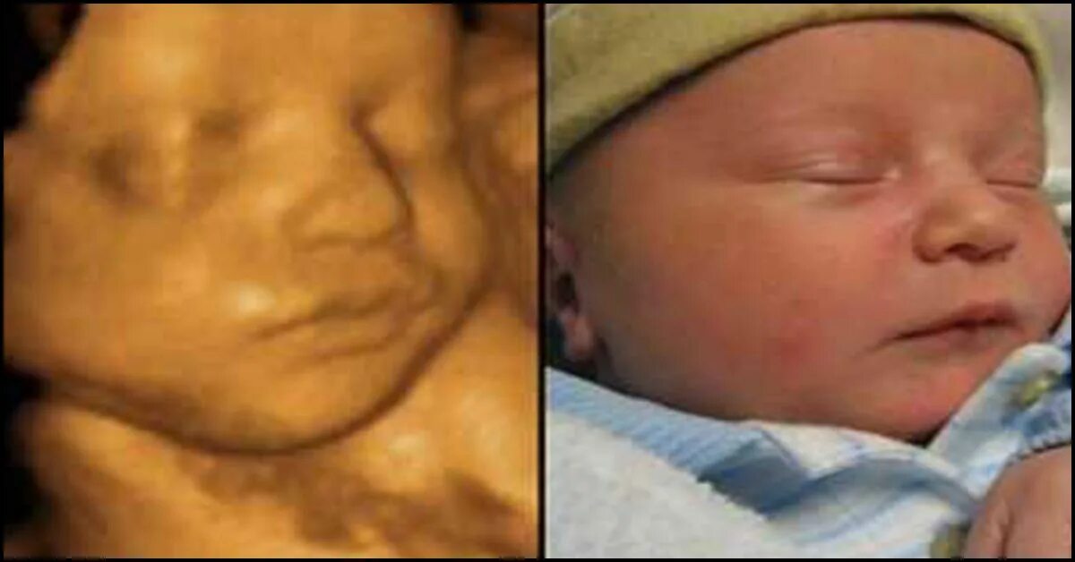 34 недели беременности фото. 3д УЗИ на 25 неделе беременности. 3д УЗИ на 26 неделе беременности.