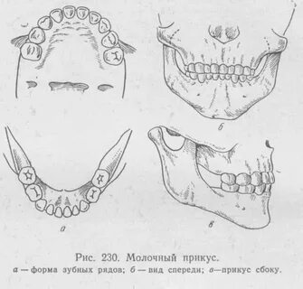 Временный прикус
