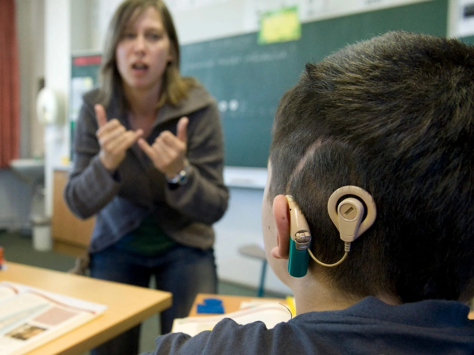 Аппарат для глухих кохлеарная имплантация. Кохлеарная имплантация Cochlear. Слабослышащие люди. Слабослышащий ученик