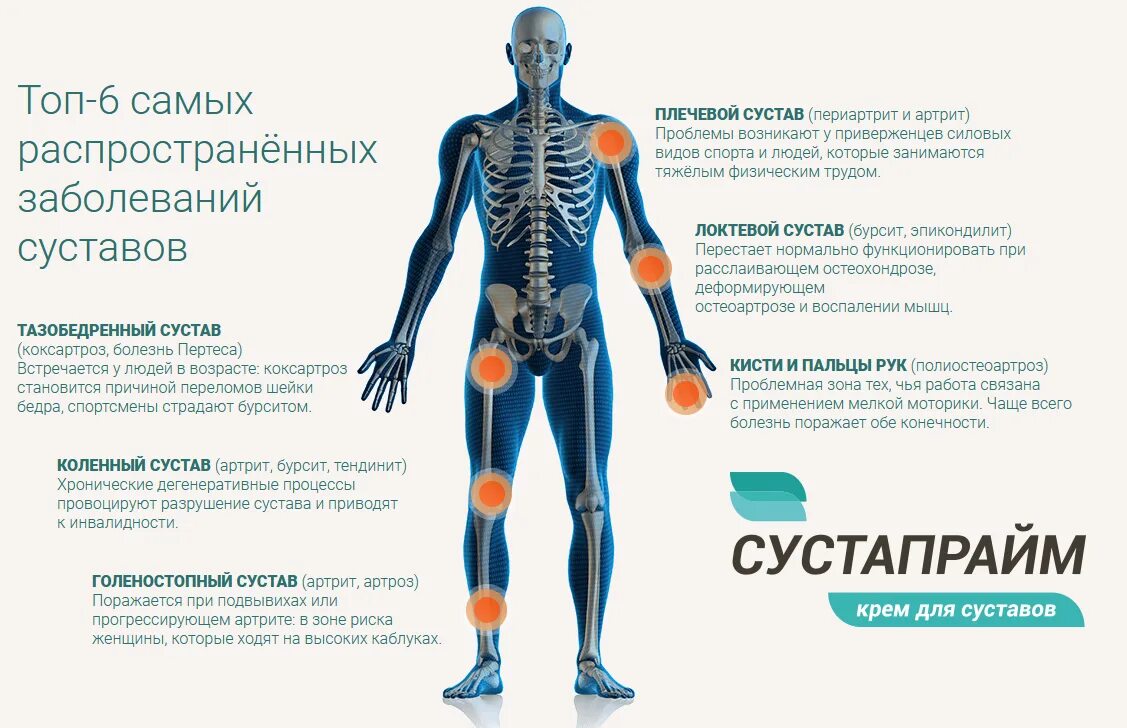 Заболевание опорно двигательный аппарат человека. Витамины для суставов и опорно-двигательного аппарата. Витамины для опорно двигательного аппарата. Витамины для костей и суставов. Болезни опорно-двигательного аппарата.