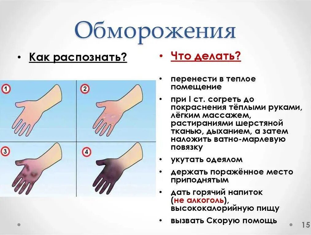 Обморожение симптомы