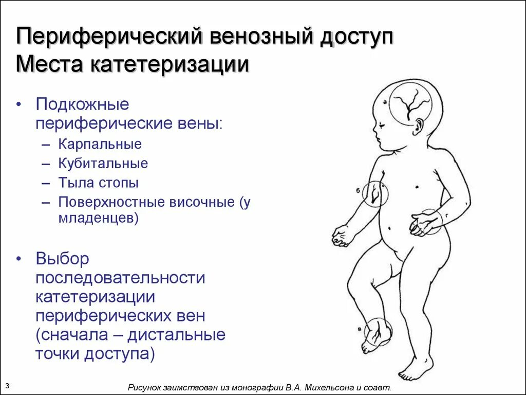 Постановка периферического катетера алгоритм. Периферическая и центральная вена. Катетеризация периферических вен алгоритм. Периферия венозная. Периферия венозная.