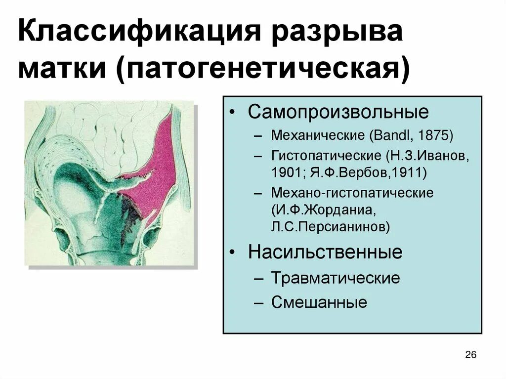 Разрыв матки классификация. Патогенез разрыва матки. Классификация разрывов матки по клинике:. Гистопатические разрывы матки.