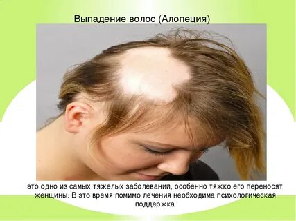 Диагноз волос
