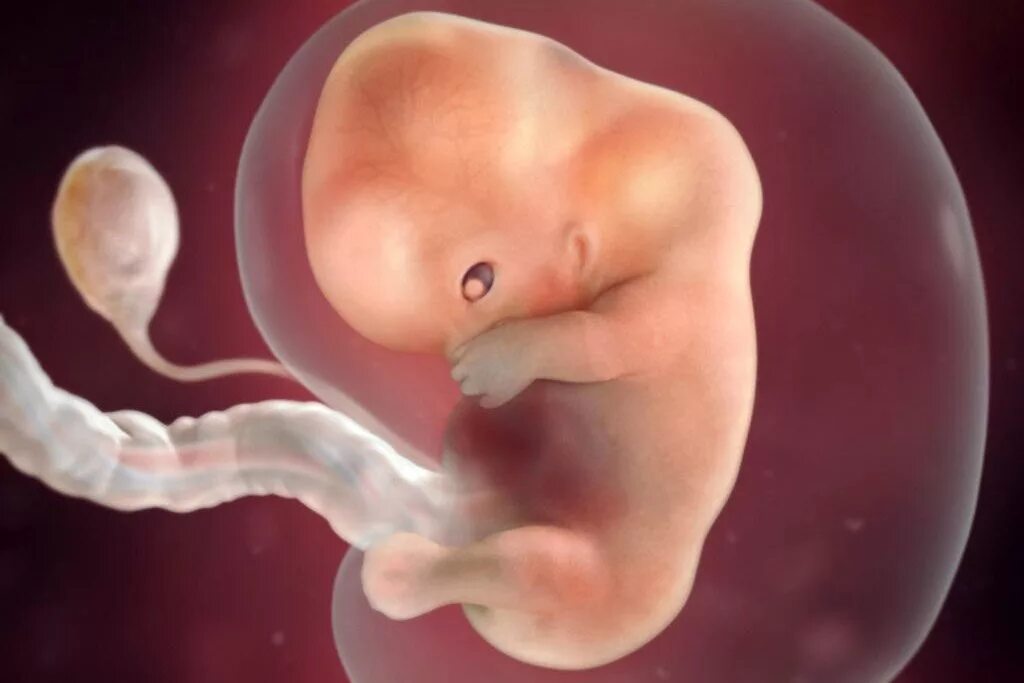 Эмбрион на 9 неделе беременности. Зародыш на 9 неделе беременности. Плод ребенка на 9 неделе беременности. Поод на 9 неделе беременности.