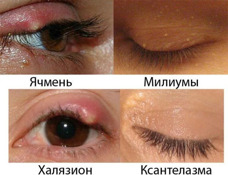 Можно с ячменем ходить в школу. Можно с ячменем ходить в школу