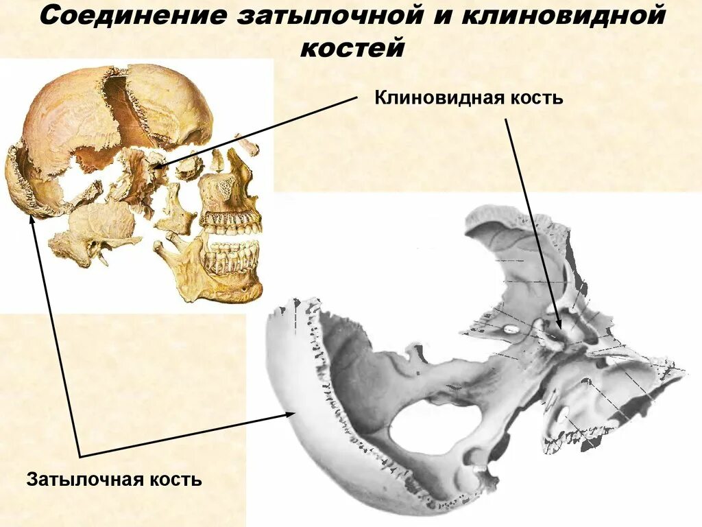 Тип соединения височной кости. Клиновидная и затылочная кость соединение. анатомия костей черепа клиновидная кость. отростки клиновидной кости черепа. височная кость и клиновидная кость.