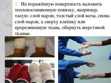 Обморожения наложение повязок