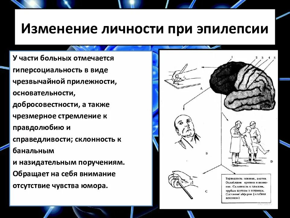 Изменение личности при эпилепсии. Изменение психики при эпилепсии. Нарушение психики при эпилепсии. Эпилепсия психические расстройства. Эпилептический удар