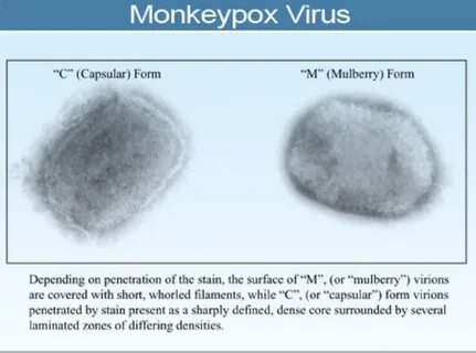LIST: 7 Essential Tips On How To Avoid Monkeypox. / https://jaanzieoutfits.com/