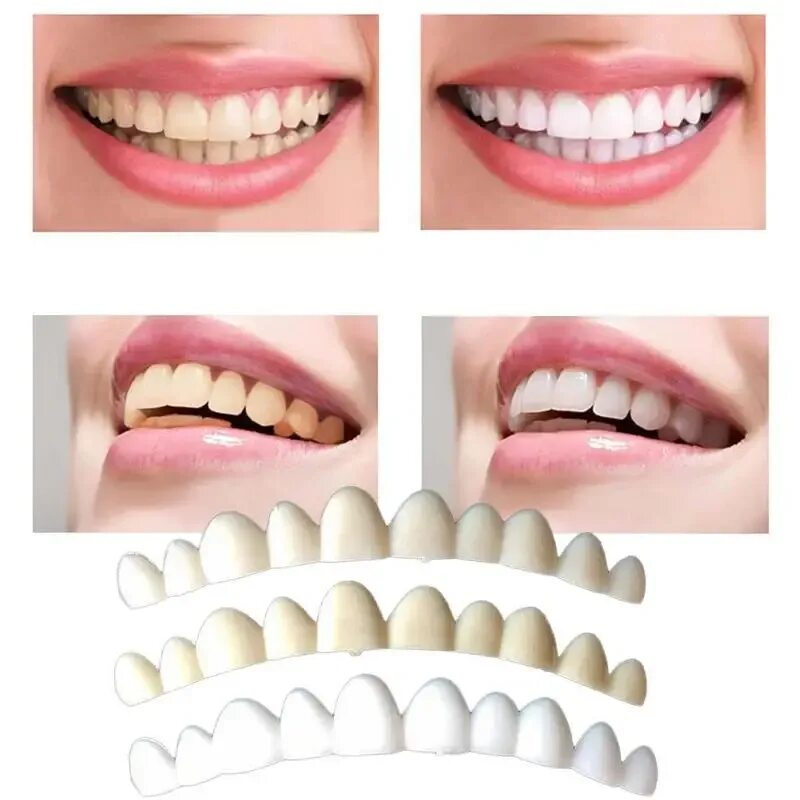 Fake Tooth Cover - Tooth Whitening Products - AliExpress