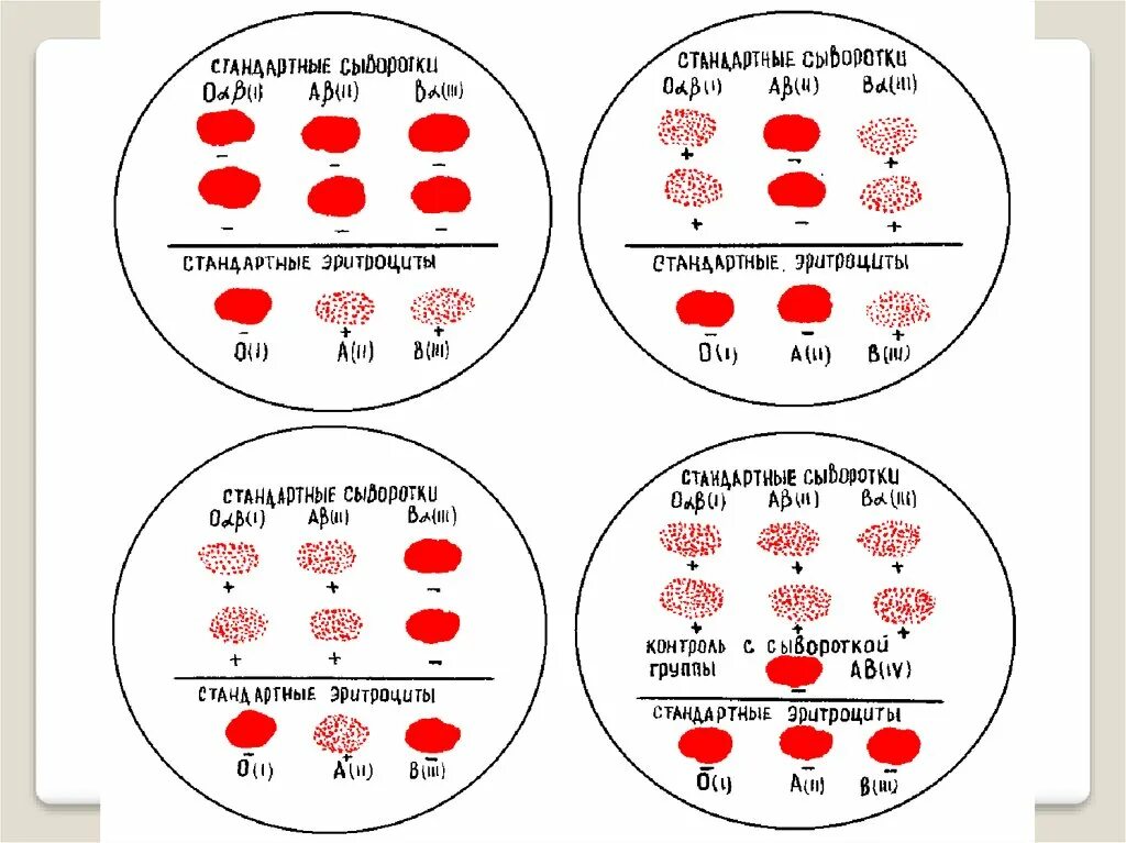 Откуда берет кровь на группу крови. Определение группы крови методом агглютинации. Группа крови стандартные эритроциты. Цоликлонами группа крови и стандартные эритроциты. Стандартные эритроциты для определения групп крови на плоскости.