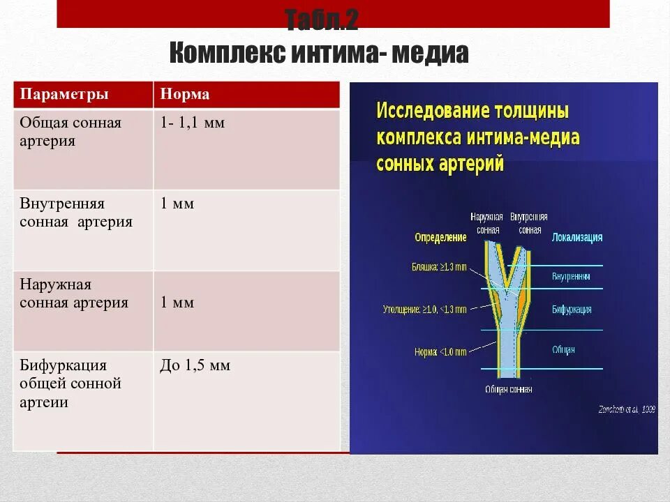 Атеросклероз внечерепных отделов бца