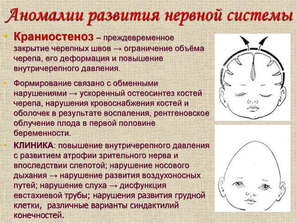 Аномалии развития нервной системы. Пороки развития нервной системы человека. Врожденные заболевания и пороки развития нервной системы.. Аномалии развития нервной системы у детей.