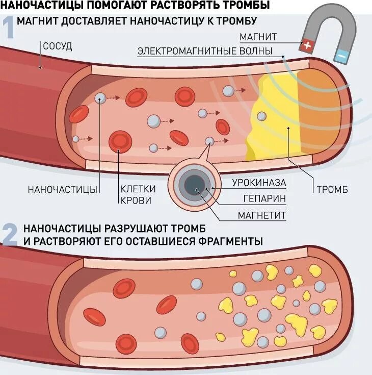 Препарат растворяющий тромбы. Препараты растворяющие тромбы