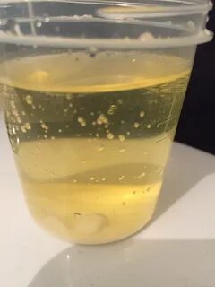 С мочой в том