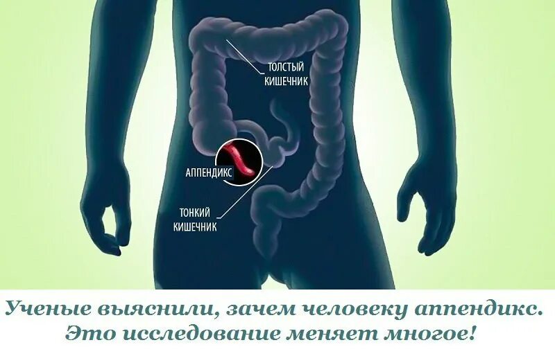 Яичники и аппендикс где находятся у женщины. Расположение аппендикса у человека. Функции аппендикса в организме. Толстый кишечник и аппендикс.