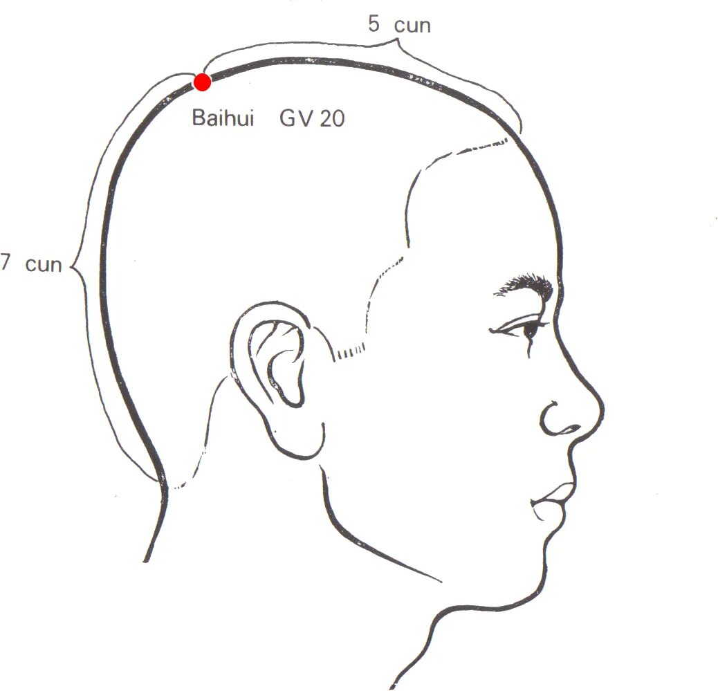 Точка gv20. Точка на макушке головы бай Хуэй. Vg20 точка акупунктуры. VG 20 бай Хуэй. Находится бай