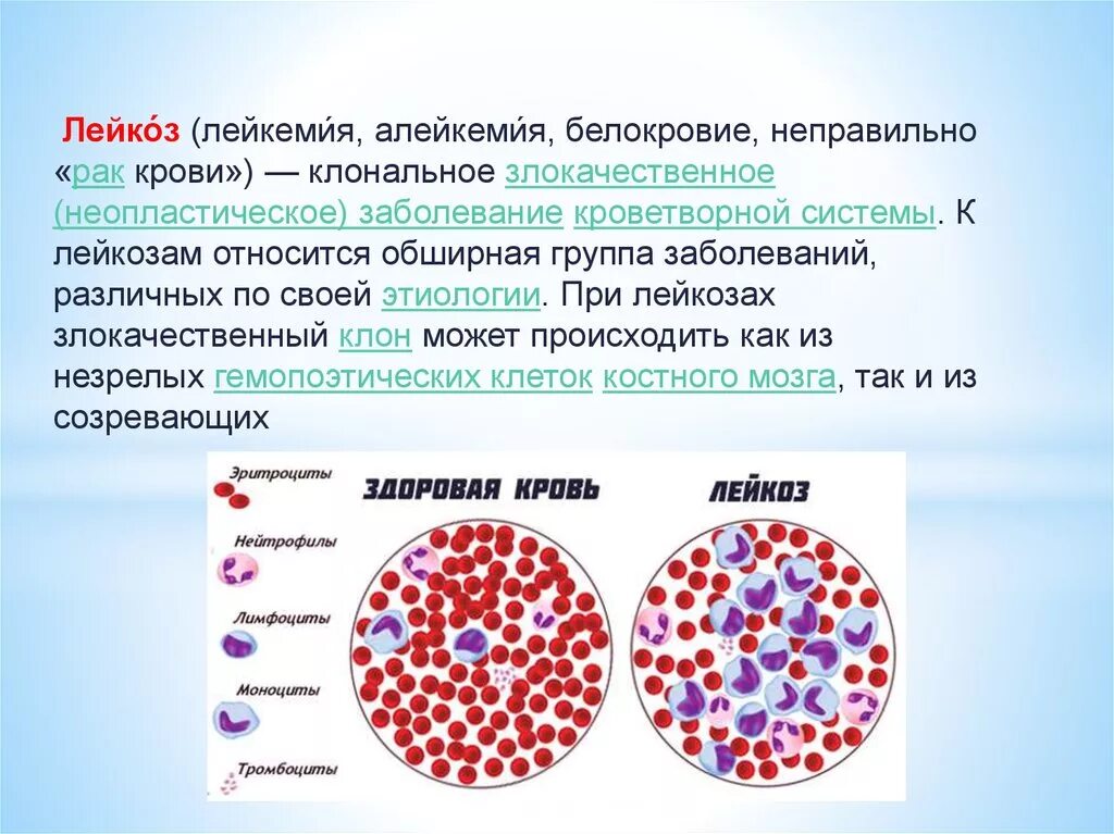 Сколько живут с лейкозом. Заболевание системы крови лейкозы. Здоровая клетка лейкоз. Тромбоцитарный лейкоз.