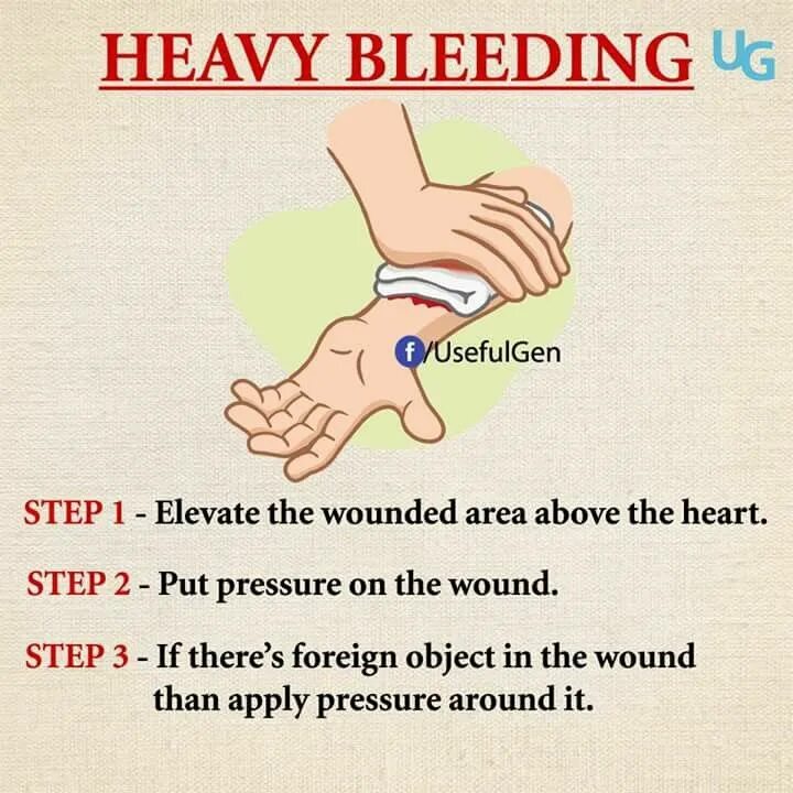 First aid bleeding. First aid bleeding