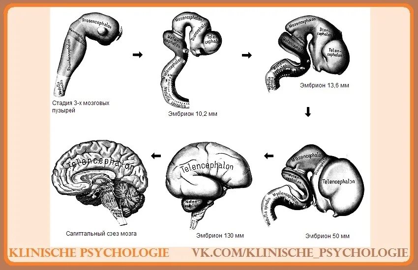 Развитие головного мозга в эмбриогенезе. Схему развития головного мозга человека. Эмбриогенез головного мозга человека. Эмбриогенез головного мозга схема. Изгибы мозга