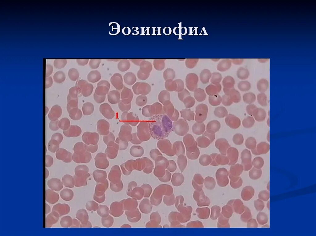 Эозинофилы гистология. Моноциты крови препарат гистология. моноциты строение гистология. моноциты в мазке крови.