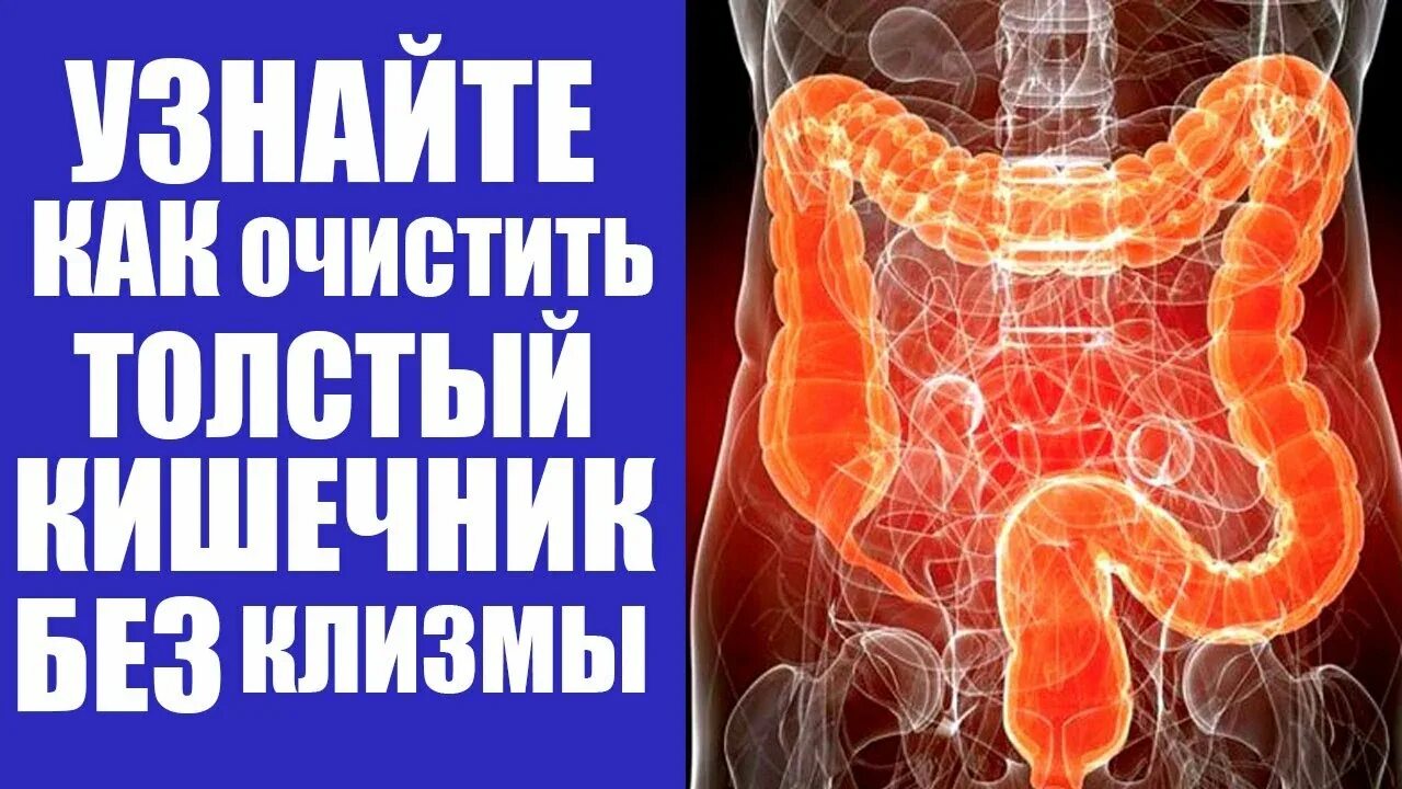 Можно удалить толстую кишку. Можно удалить толстую кишку. Колостома сигмовидной. Колостома сигмовидной кишки. Можно удалить толстую кишку.