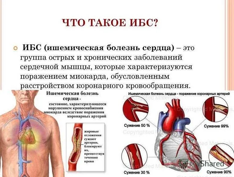 Сколько живут с ишемией. Ишемическая болезнь сердца (ИБС). Клинические проявления ишемической болезни сердца. Ишемическая болезнь сердца поражение миокарда. Проявления ишемической болезни сердца хронической и острой.