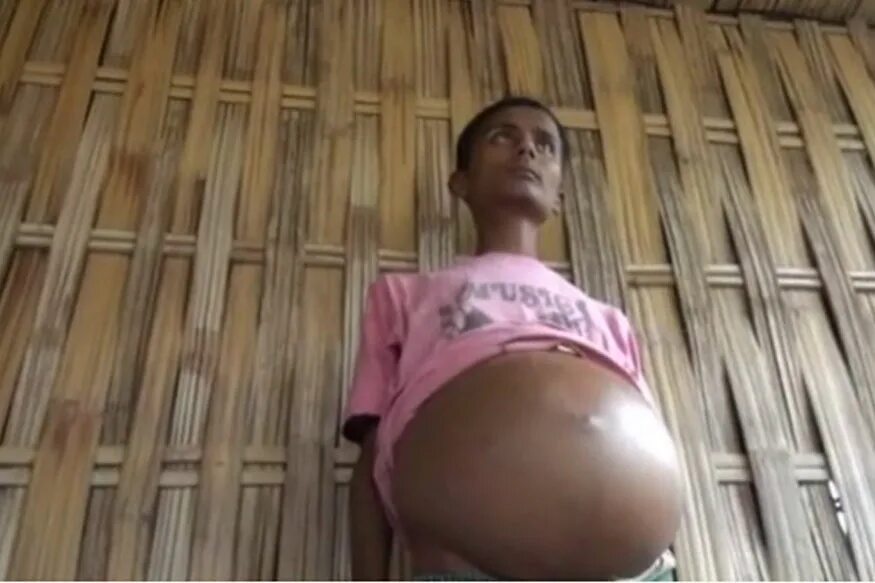 самые большие животы