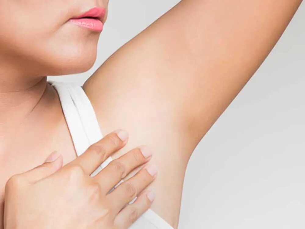 Гидраденит в подмышечной впадине. Болят подмышки у женщин. Повышенная потливость. Болят подмышки у женщин. Гидраденит в подмышечной впадине.