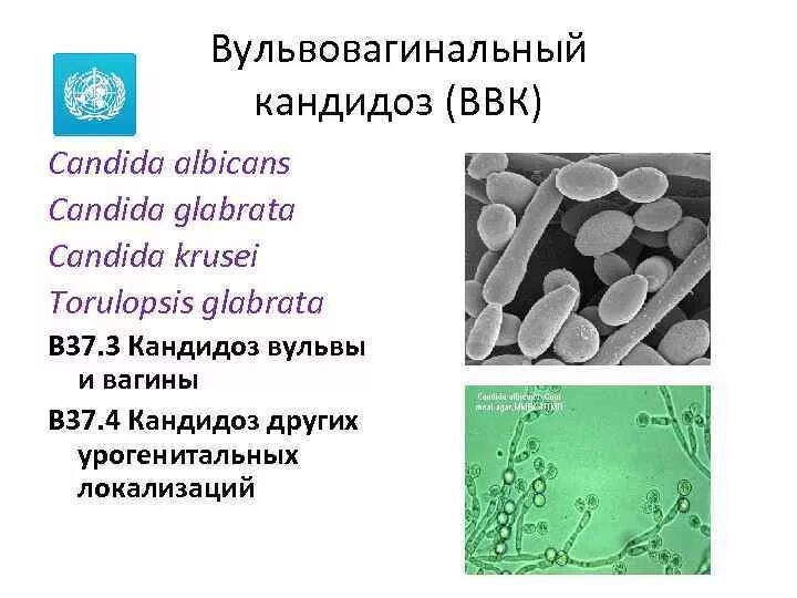 Candida albicans лечение. Вульвовагиональный кандид. Урогенитальный кандидоз урогенитальный кандидоз.