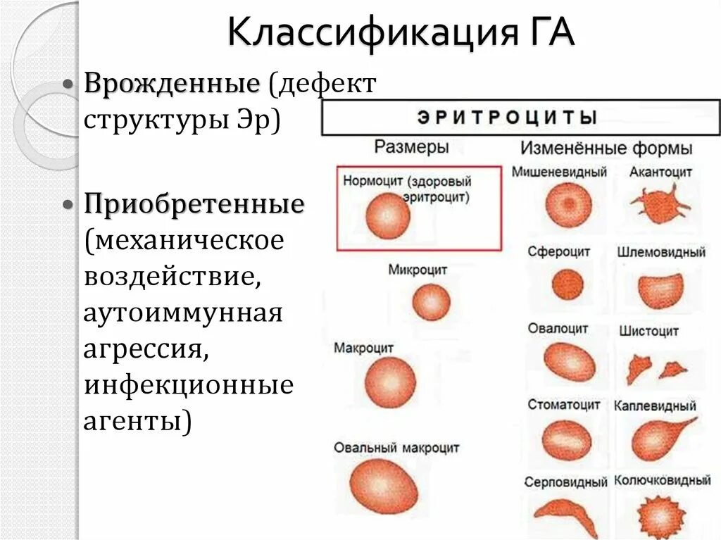 Врожденные гемолитические анемии. Гемолитическая анемия эритроциты форма. Гемолитическая анемия картина крови. Классификация врожденных гемолитических анемий. Формы эритроцитов при анемии.