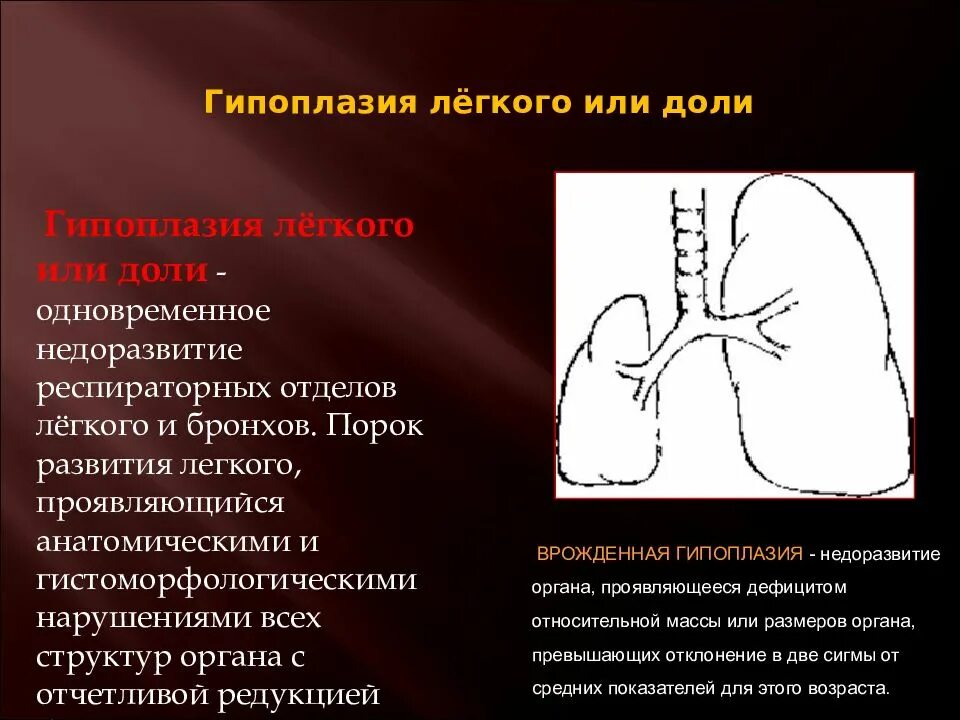 Аномалии органов дыхания