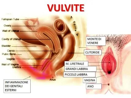dose Allegations Nervous breakdown arrossamento parti intime donna pivot Mauve e