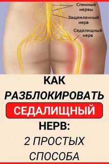 Как разблокировать седалищный нерв - hdmulty.ru