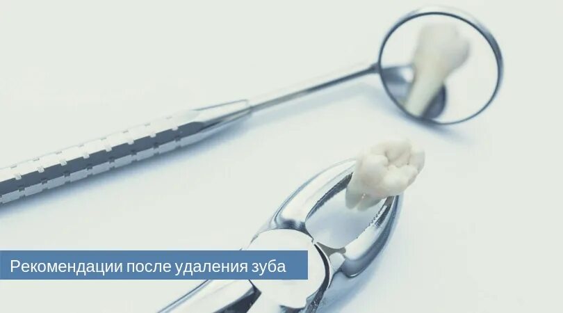 Можно пить чай после удаления зуба. Рекомендации пациенту после удаления зуба. Рекомендации стоматолога после удаления зуба. Удалили зуб рекомендации. Послеоперационные рекомендации после удаления зуба.