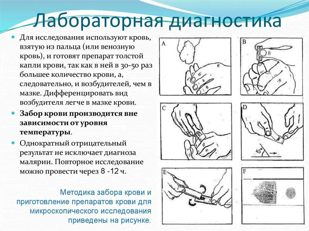 Для диагностики малярии забор крови осуществляют. Забор капиллярной крови схема. Техника забора капиллярной крови. Алгоритм взятия капиллярной крови у детей. Методика взятия крови из пальца.