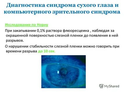 Синдром зрительных нарушений