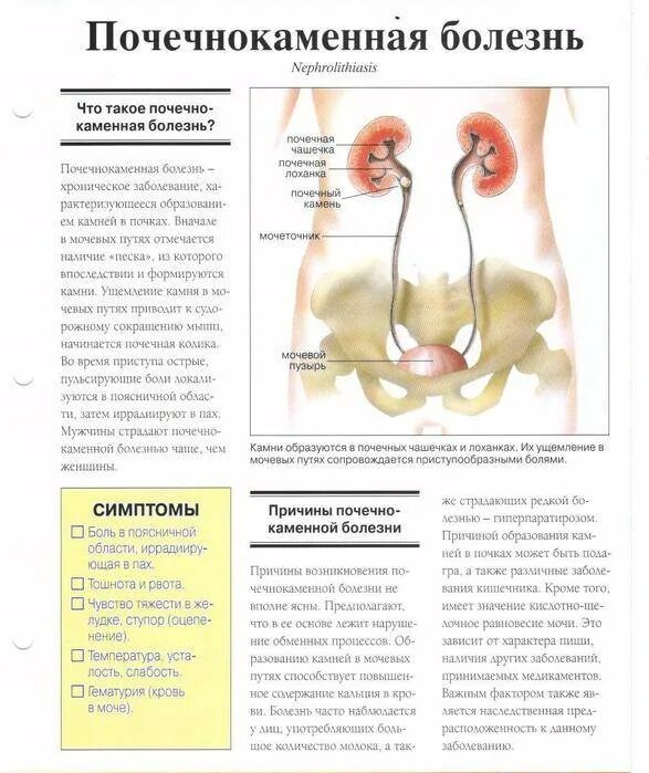Мочекаменная болезнь симптомы причины меры профилактики. Памятка пациенту с мочекаменной болезнью. Психосоматика болезней почек. Мочекаменная болезнь памятка. Боль в почках психосоматика.